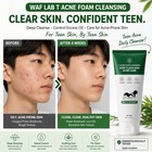 Waf Lab T Teen Acne Foam Cleansing 150ml Sebum Care Deep Clean K-beauty