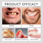 Diy Resin Dentures Veneers Set For Men And Women Upper And Lower False Teeth