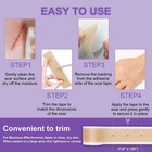 Silicone Scar Sheets  Medical Grade Silicone Scar Tape 1 6  X 120   professional