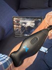 Butterfly Iq   Portable Ultrasound Probe Ultrasound