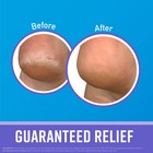 For Healthy Feet Night Treatment Foot Cream  Guaranteed For Extremely Dry  Cr   