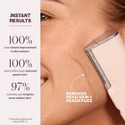 Dermaflash Luxe  Sonic Dermaplaning Tool For Face Peach Fuzz Removal  Anti-ag   