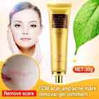 Lanbena Acne Scar Stretch Marks Remover Cream Skin Repair Acne Black Dots Spots