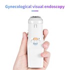 Fa3 Portable Digital Mini Colposcope self-exam Video Device For Cervical Viewing