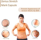 Stretch Mark Removal Capsule For Pregnancy   Reduce Stretch Marks   Scars