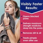 Clearasil Rapid Rescue Deep Treatment Acne Face Wash  Maximum Strenght6 78 Fl Oz