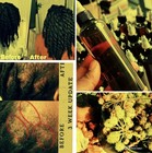 Castor Oil Growth Promoter Oil For Hair Loss Treatment For All Hair Types