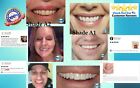 Denture Diy Boil And Bite  Upper Small  Temporary Dentures   Diy Dentures