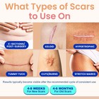 Adamson Silicone Scar Tape For Surgical Scars  Keloid  C-section  Burns   More 