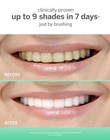 Extra White Professional Whitening Accelerator - Enamel-safe Teeth Whitening    