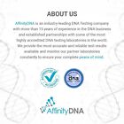 Food Intolerance Test For 900 Allergens    Home Allergy Testing Kit For 1 Person