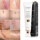 Medical-grade Scar Cream For Surgical Burns C-section Scar Stretch Marks Keloids