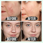 Blackhead Remover For Face - Peel Off Charcoal Black Mask  Pore Remover For N   