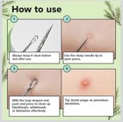 Dual-tip Reusable Stainless Steel Face Extractor Tool For Blackheads 12 4 Cm
