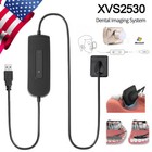 Woodpeck Style Digital Imaging Rvg Sensor X-ray System Xray Sensor 2 0  holder