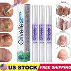 New Anti Fungal Pen Intensive Treatment Toenail Fungus Foot Nail Repair Oil