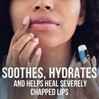 Chapstick Classic Medicated Lip Balm Tubes  Chapped Lips Treatment And Skin Prot