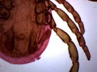 Histology Tick - Wm - Prepared Slide - 75x25mm - Eisco Labs