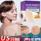 Silicone Scar Sheets  1 6  X 120  Roll- 3m  Silicone Scar Tape For Surgical Scar