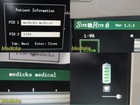 Chison Med Siterite Vi 9770066 Sherlock Ii Vascular Access Sys W  Probe   32234