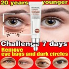 Magic Eye Cream 28 Seconds To Remove Eye Bags   Dark Circles   Eye Wrinkles