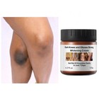 Strong Whitening Cream For Removing Dark Knuckle Finger Elbow And Knee