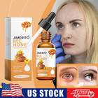 Jimerito Honey For Eyes  Jimerito Honey Eye Drops  Jimerito Bee Honey For Eye 