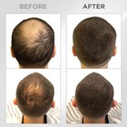 Thick Fiber Hair Fibers For Thinning Hair  Bald Spots Dark Brown - 25g Bottle   