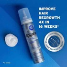 Rogaine 5  Minoxidil Unscented Foam Hair Regrowth Treatment 3 Month
