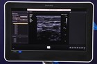 Philips Epiq 7g Elite Diagnostic Ultrasound System