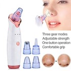 Electric Blackhead Remover Pore Vacuum Suction Diamond Dermabrasion Face