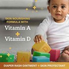 A d Diaper Rash Ointment For Baby    Select Your Type   Size   - Best Product 
