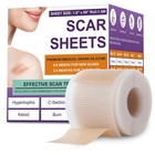 Silicone Scar Sheets  Medical Grade Silicone Scar Tape For Old   New Scars