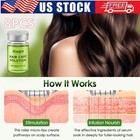 8pcs Advanced Hair Growth Serum Anti Hair Loss Fast Regrowth Scalp Treatment Us