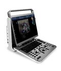 Chison Ebit50vet Veterinary Software Color Doppler High End Portable Ultrasound