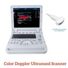 Portable Laptop Machine Digital Ultrasound Scanner Color Doppler Convex 15  Lcd