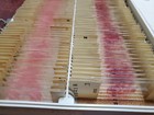 Vtg 92 Piece Glass Microscope Histology Slides   Bone Marrow Cellularity Four