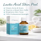 Lactic Acid 70  Face Peel Exfoliating Skin Resurfacing Solution