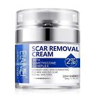 Scar Removal Cream - Rapid Repair Of New   Old Scars  Acne Spots  Burns