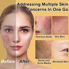 Complete Deep Hydration Skin Care Kit For Extremely Dry Skin Anti Aging Gift Set