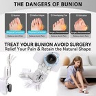 Toe Separator Hallux Valgus Bunion Corrector Orthotics Adjuster Correction Sport