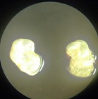 Antique Microscope Slide   Foraminifera Vertebralina From King Georges Sound