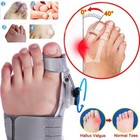 Bunion Fix Toe Valgus Corrector Adjustable Orthosis Women Men Splints Day night