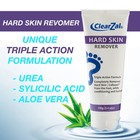 Foot Cream For Hard Skin  Helps Calluses And Corn Removal While Leaving Soft    
