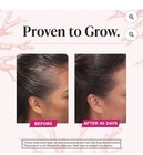 Hair Growth Dietary Supplement Collagen Complex 180 Tablets
