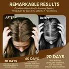 Raw Batana Oil For Hair Growth-100 pure   Natural Hairs Batana Oil promotes 30ml