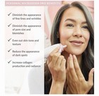 Pmd Beauty Personal Microderm Pro - At-home Use  Facial Exfoliator Tool - New