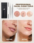 Sgnekoo Professional Facial Milia Removal Tool And Gold-2p  Stainless Silver