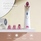 Blackhead Remover Pore Vacuum Electric Blackhead Extractor Tool Comedo Removal
