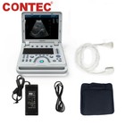 Us Veterinary Ultrasound Scanner Color Doppler Portable Vet Machine Convex Probe